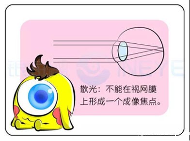 散光5